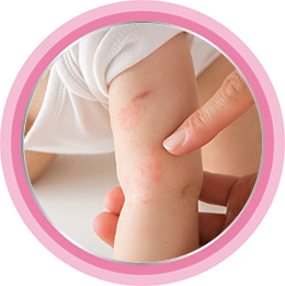 Причины появления атопического дерматита у детей